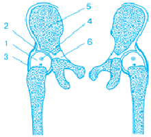 Рис. 1. Схема строения нормального тазобедренного сустава у новорожденного